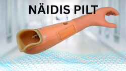 Ülajäseme proteesid