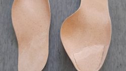 Eritüüpi tallatoed tugevalt moondunud jalale