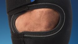 NRX® Patella Luxation