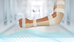 Individuaalsed ortoosid