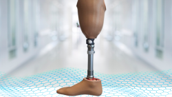 Alajäseme proteesid