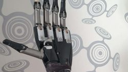 Müoelektriline küünarvarreprotees Össur i-Limb®.