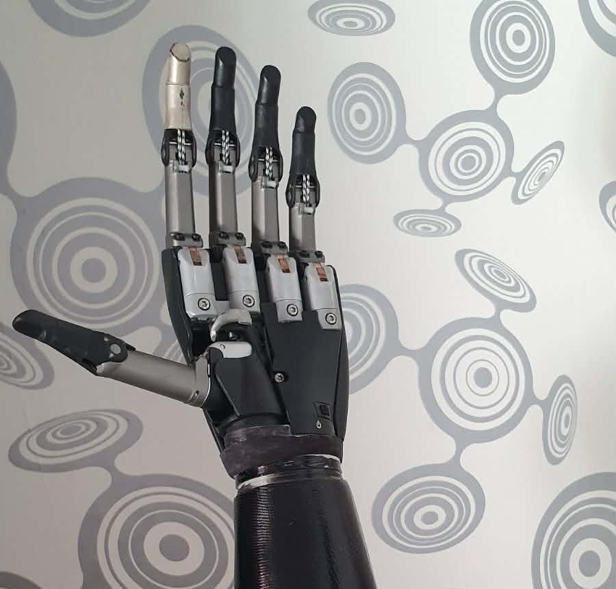 Müoelektriline küünarvarreprotees Össur i-Limb®.